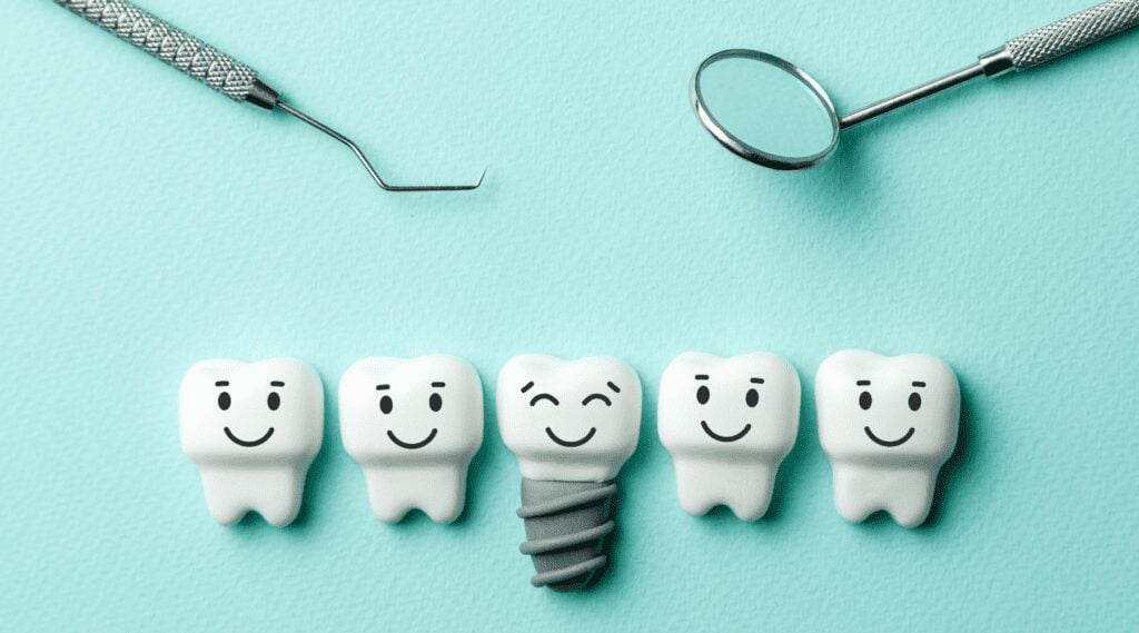 dental implants in huntsville
